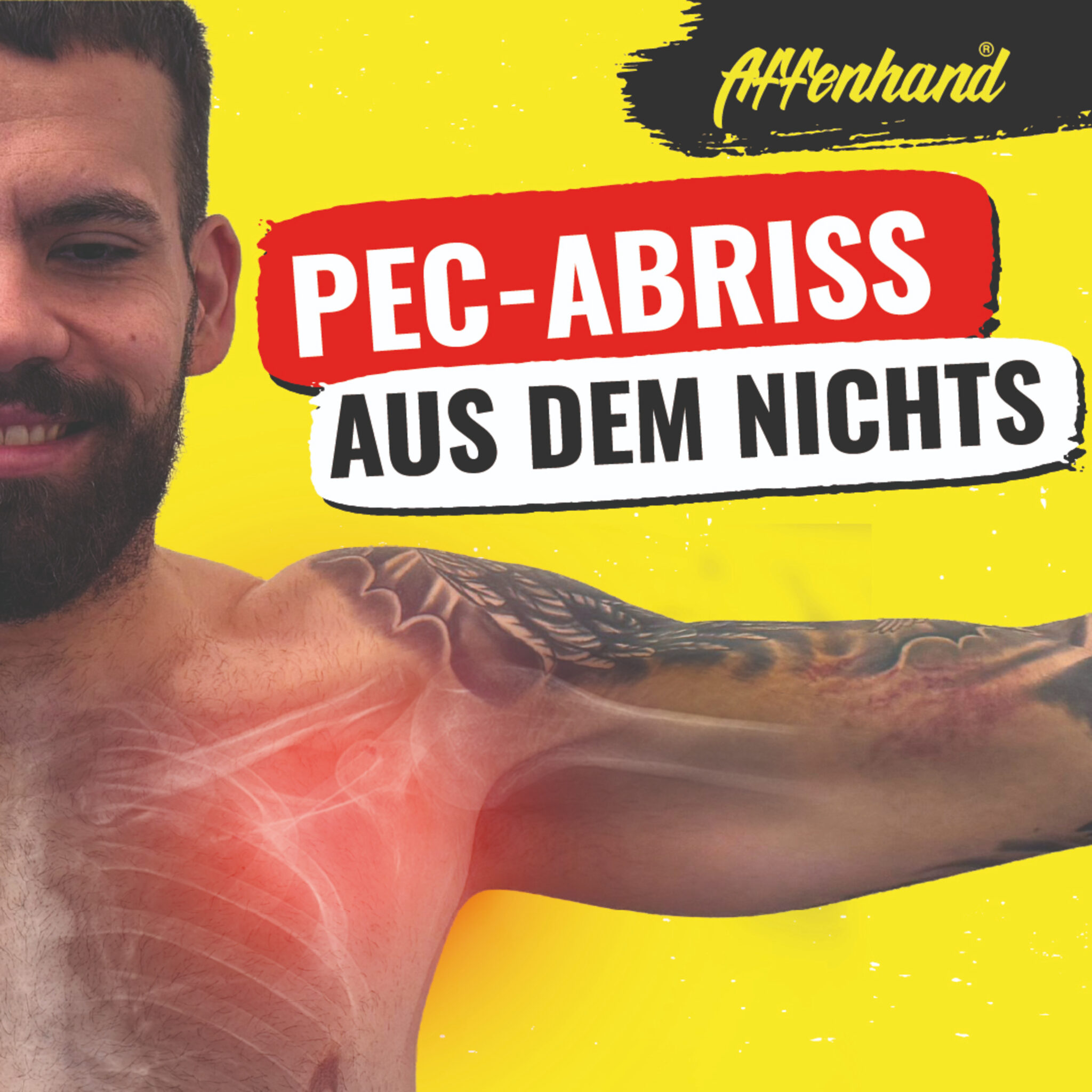 Pec-Abriss Reha: Zurück ins Training nach schwerer Sportverletzung | Max Keller & Matthias Lau – Affenhand Podcast